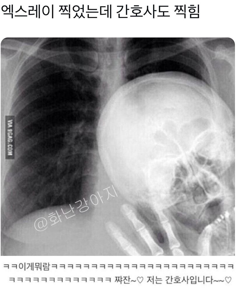 Ho - 많은 분들의 기도와 응원덕분에 김성애여사는 수술 잘 마치고 병실에서 회복중입니다. 흉부 수술을 했던 다른 환자분들보다 통증도  적어보이고 잘 참고 있다는 간호사들의 이야기에 위로를 얻었습니다. 함께 기도해주셔서 감사합니다..^^ (..실사를 올렸다가 나중에, image size:830x992